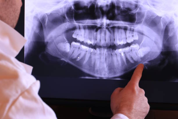 Best Emergency Dental Care for Broken or Chipped Teeth in Heavener, OK